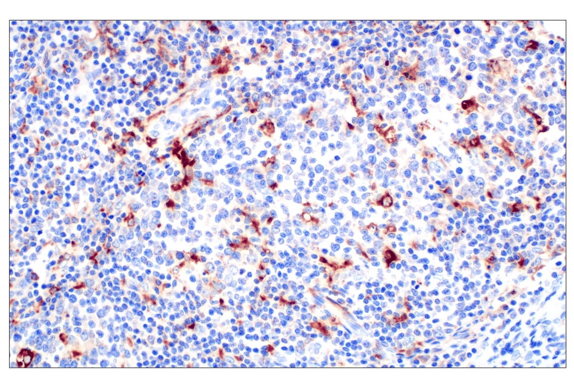 Cathepsin Z (F4M4S) Rabbit Monoclonal Antibody | Cell Signaling