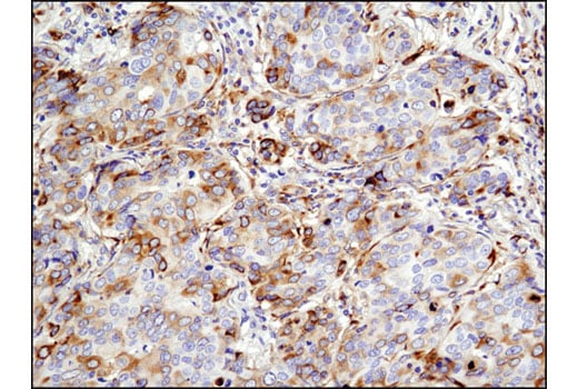 Immunohistochemistry Image 2: SignalStain<sup>®</sup> DAB Substrate Kit