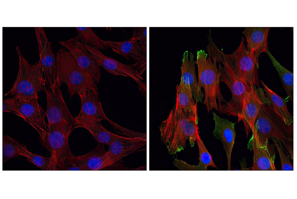 undefined Image 21: Insulin/IGF-1 Signaling Pathway Antibody Sampler Kit