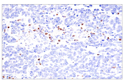 Immunohistochemistry Image 5: GNLY (E2T3D) Rabbit Monoclonal Antibody