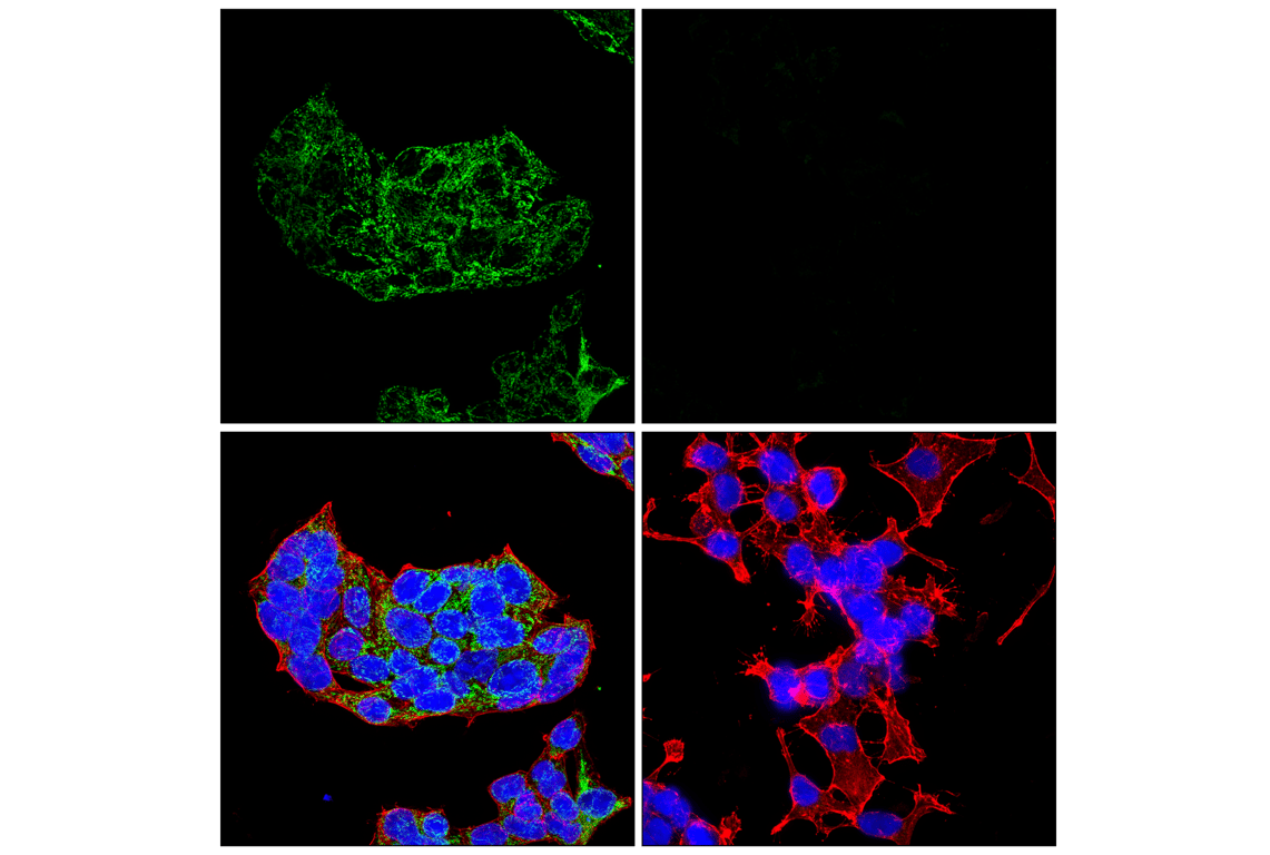Immunofluorescence Image 1: GOT2 (F4P3R) Rabbit Monoclonal Antibody