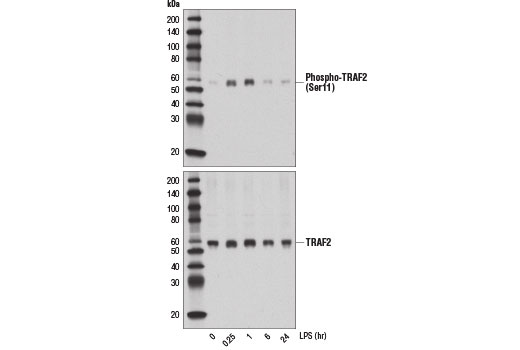 Western Blotting Image 2: Phospho-TRAF2 (Ser11) (E2B6L) Rabbit Monoclonal Antibody
