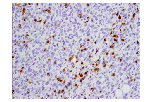 Immunohistochemistry Image 1: PD-1 (Intracellular Domain) (D7D5W) Rabbit Monoclonal Antibody (BSA and Azide Free)