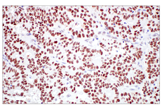 Immunohistochemistry Image 2: TIF1 alpha/TRIM24 (E9T3N) Rabbit Monoclonal Antibody