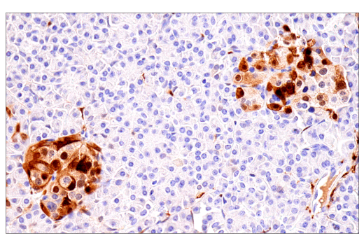 Immunohistochemistry Image 6: S100B (E7C3A) Rabbit Monoclonal Antibody (BSA and Azide Free)