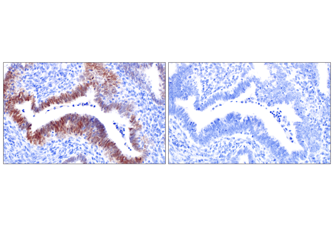 Immunohistochemistry Image 5: SIX3 (F1I1S) Rabbit Monoclonal Antibody