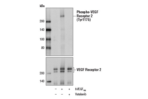undefined Image 2: Vatalanib