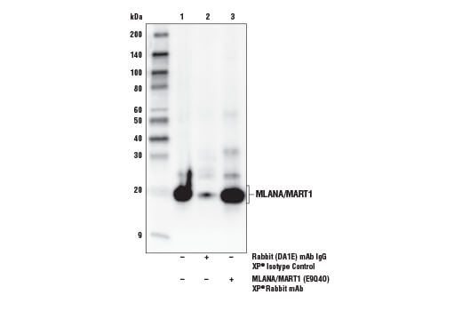 Immunoprecipitation Image 1: MLANA/MART-1 (E9Q4O) Rabbit Monoclonal Antibody