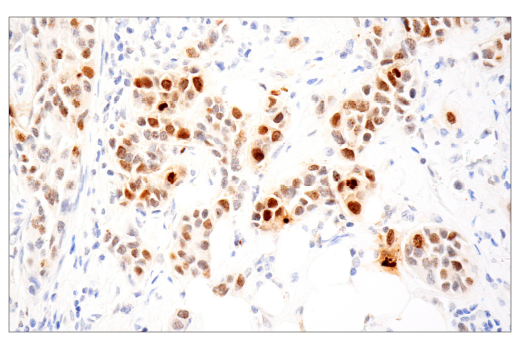 Immunohistochemistry Image 2: Phospho-Histone H2A.X (Ser139) (D7T2V) Mouse Monoclonal Antibody