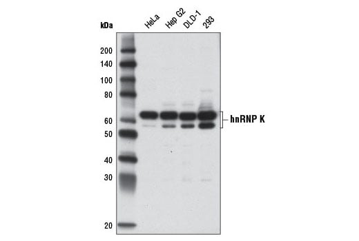 Western Blotting Image 1: hnRNP K (D9A8) Rabbit mAb