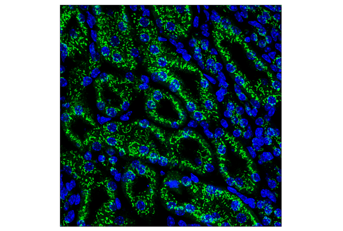 undefined Image 46: Organelle Localization IF Antibody Sampler Kit