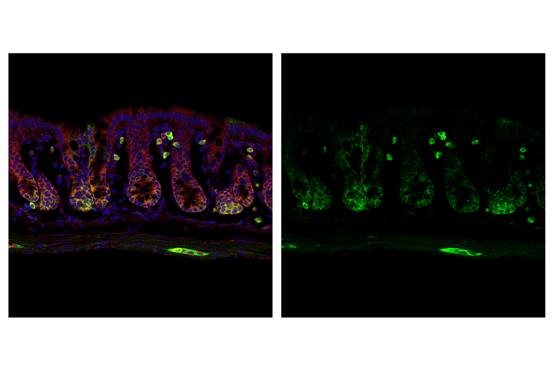 Immunofluorescence Image 2: PHGDH (D3D5E) Rabbit Monoclonal Antibody (IF Formulated)