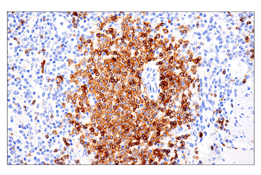 CD22 (E7L6Z) XP® Rabbit mAb | Cell Signaling Technology
