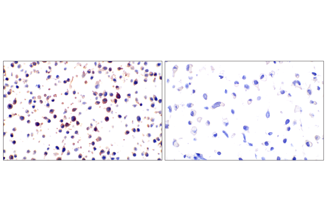 Immunohistochemistry Image 7: FAP (F1A4G) Rabbit Monoclonal Antibody
