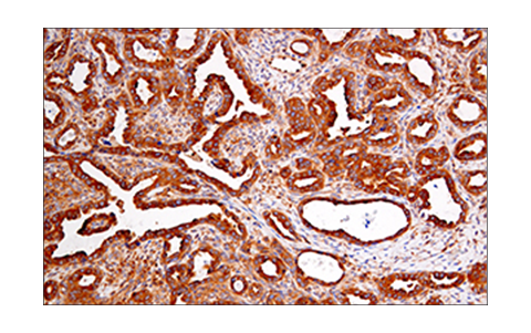 Immunohistochemistry Image 7: RIP (E8S7U) Rabbit Monoclonal Antibody (BSA and Azide Free)