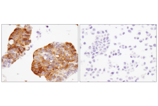 Immunohistochemistry Image 4: MX1 (D3W7I) Rabbit Monoclonal Antibody (BSA and Azide Free)