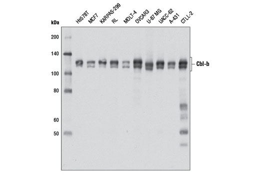 Western Blotting Image 2: Cbl-b (D3C12) Rabbit Monoclonal Antibody