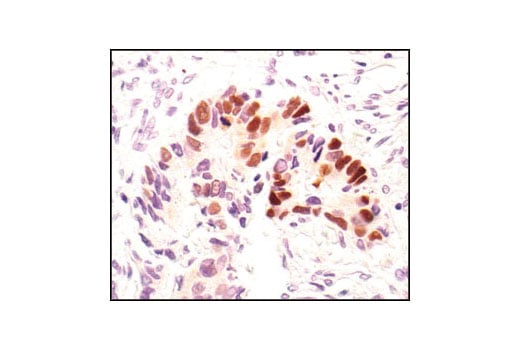 undefined Image 18: p53 Antibody Sampler Kit