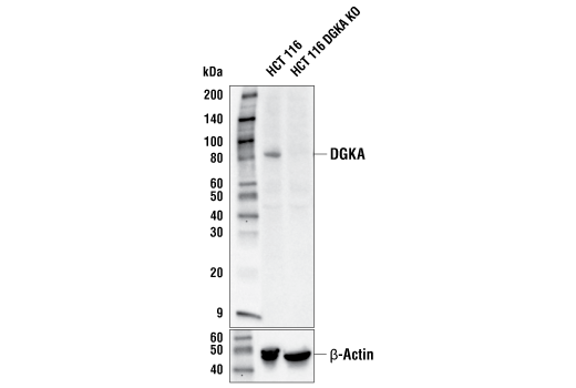 Western Blotting Image 2: DGKA (E2Z7V) Rabbit Monoclonal Antibody