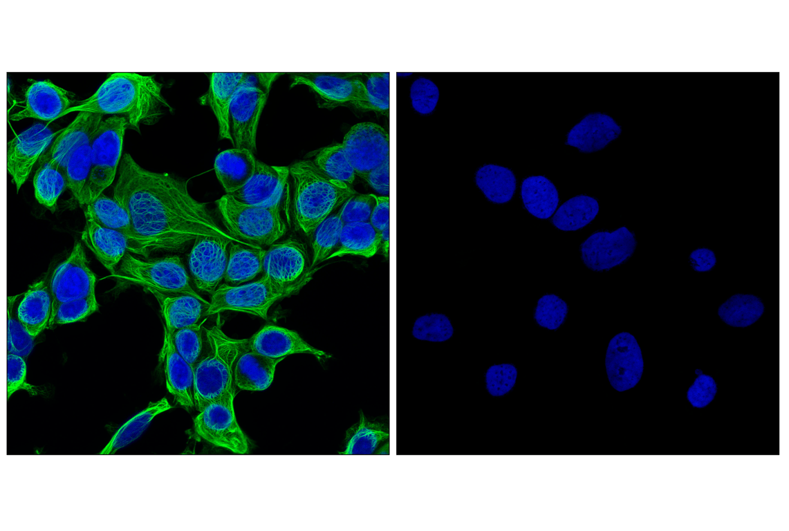 Immunofluorescence Image 1: Keratin 8/18 (C51) Mouse Monoclonal Antibody