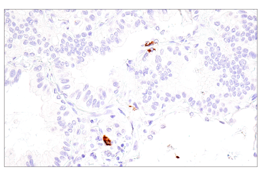 Immunohistochemistry Image 3: CD1A (MTB1) Mouse Monoclonal Antibody