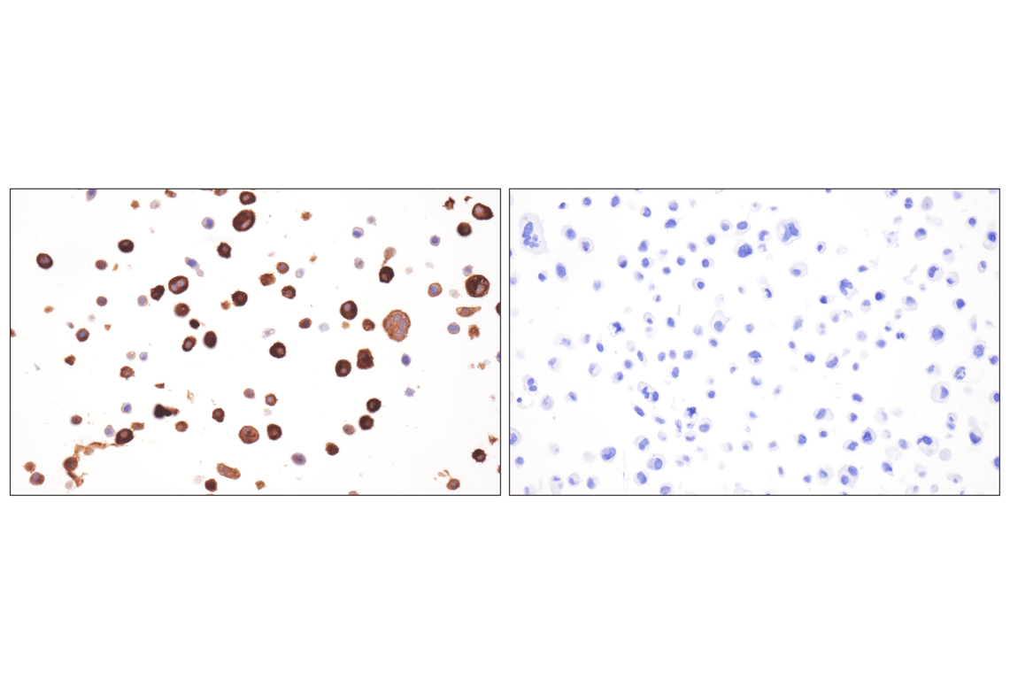 Immunohistochemistry Image 3: Respiratory Syncytial Virus (RSV) Nucleoprotein (N) (F5S9J) Rabbit Monoclonal Antibody