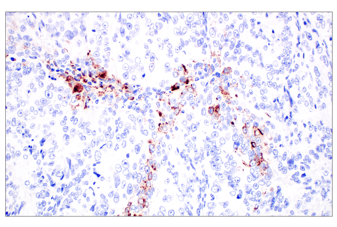 Immunohistochemistry Image 2: CHGA (F7D6H) Rabbit Monoclonal Antibody