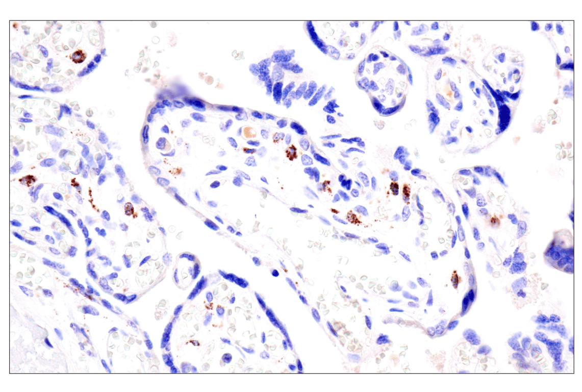 Immunohistochemistry Image 13: AMACR (F7T6V) Rabbit mAb