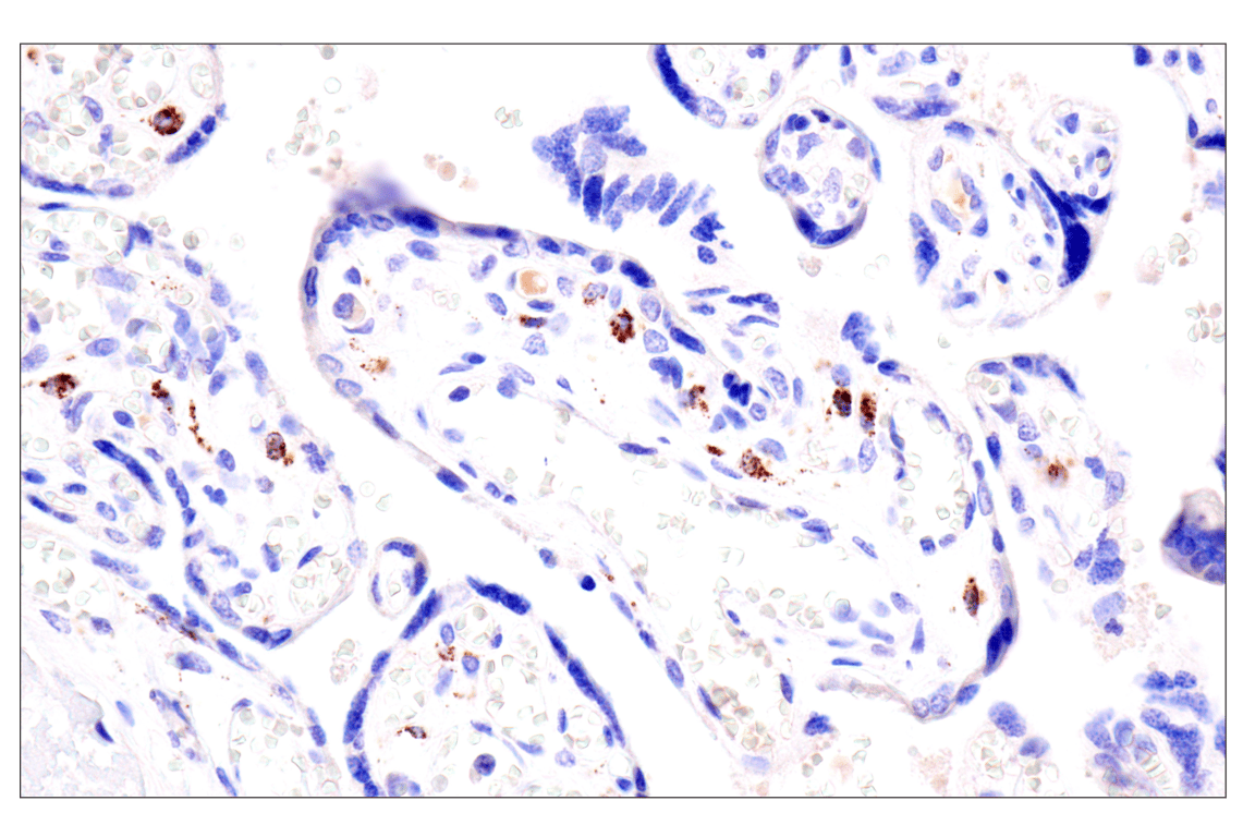 Immunohistochemistry Image 13: AMACR (F7T6V) Rabbit Monoclonal Antibody