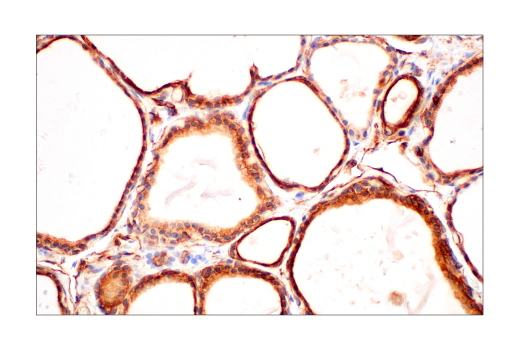 Immunohistochemistry Image 8: Phospho-Tyrosine (4G10) Mouse Monoclonal Antibody