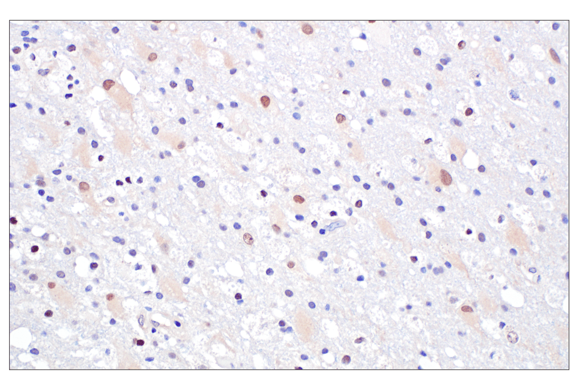 Immunohistochemistry Image 10: TFE3 (F3Z2Q) Rabbit Monoclonal Antibody