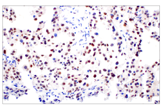 Immunohistochemistry Image 4: C/EBP beta (E2K1U) Rabbit Monoclonal Antibody