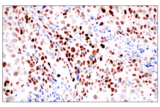 Immunohistochemistry Image 4: p53 (DO-1) Mouse Monoclonal Antibody