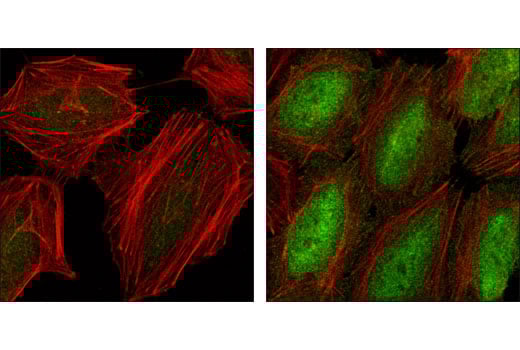 Immunofluorescence Image 1: Phospho-NF-kappaB p65 (Ser536) (93H1) Rabbit Monoclonal Antibody (BSA and Azide Free)