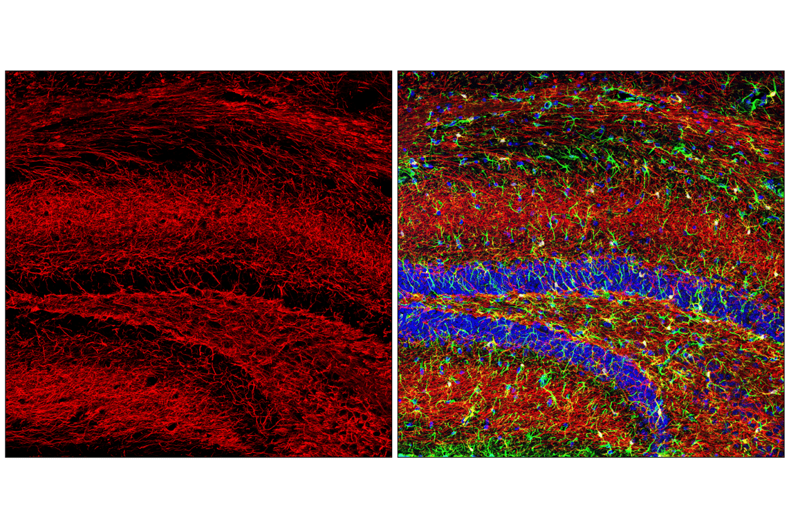 Immunofluorescence Image 1: Neurofilament-H (E7Z7G) Rabbit Monoclonal Antibody (BSA and Azide Free)