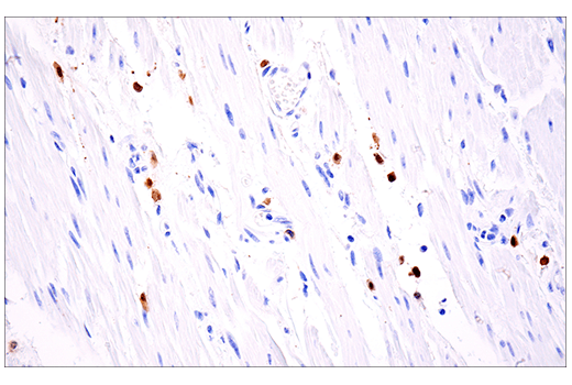 Immunohistochemistry Image 3: Calretinin (E7R6O) XP<sup>®</sup> Rabbit mAb (BSA and Azide Free)