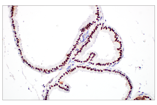 Immunohistochemistry Image 9: XRCC1 (E4A3V) Rabbit Monoclonal Antibody