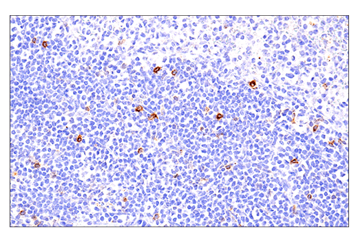 Immunohistochemistry Image 5: 4-1BB/CD137/TNFRSF9 (E2J5H) Rabbit Monoclonal Antibody