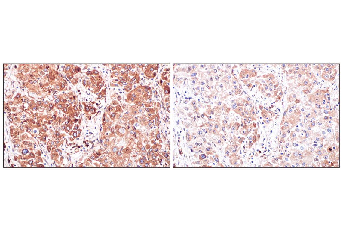 Immunohistochemistry Image 8: PABP1 (F6G6L) Rabbit Monoclonal Antibody