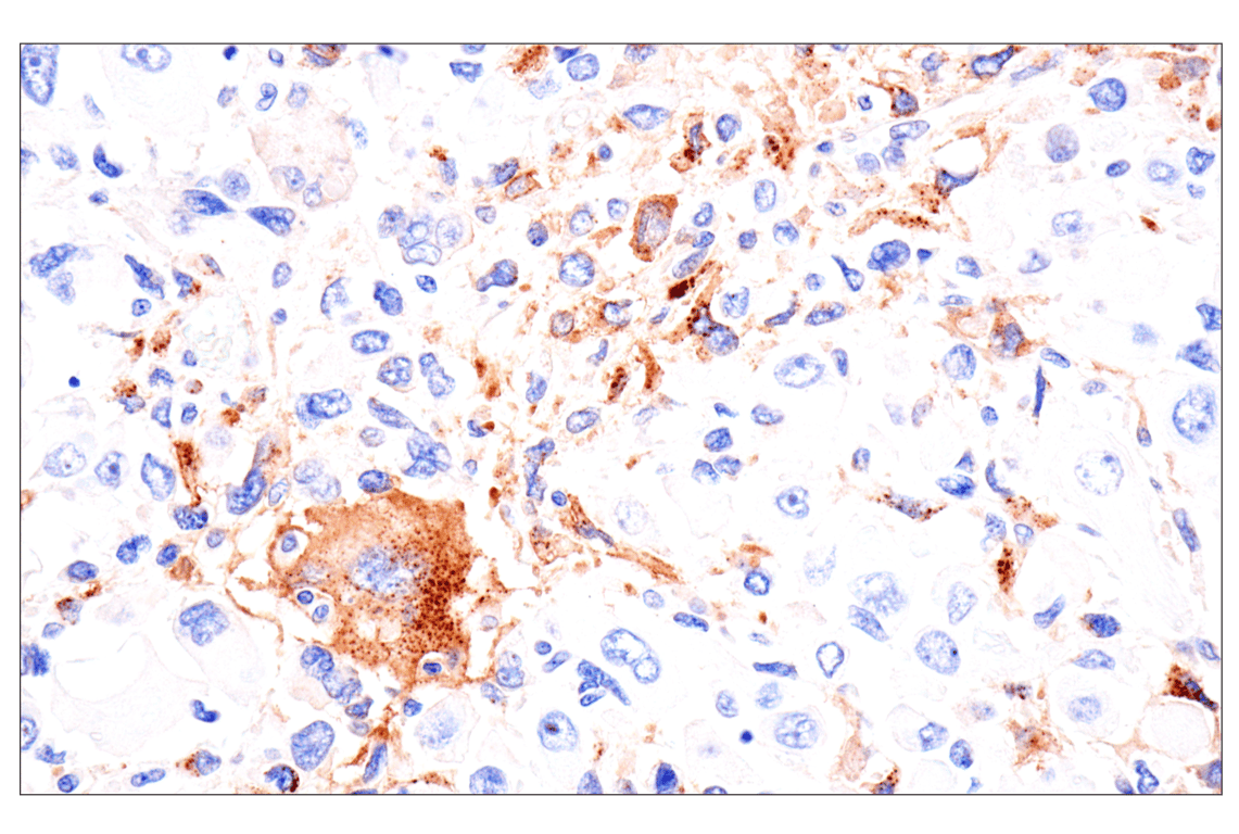 Immunohistochemistry Image 2: FAP (F1A4G) Rabbit Monoclonal Antibody
