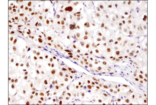 Immunohistochemistry Image 2: PROX1 (D2J6J) Rabbit Monoclonal Antibody (BSA and Azide Free)