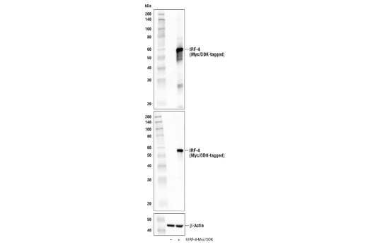 Western Blotting Image 4: IRF-4 (E8H3S) XP<sup>®</sup> Rabbit mAb