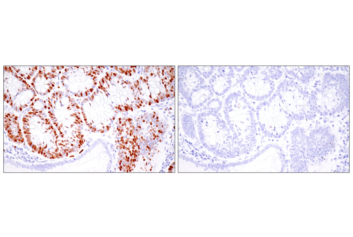 Immunohistochemistry Image 14: UHRF1 (E5W8W) Rabbit Monoclonal Antibody