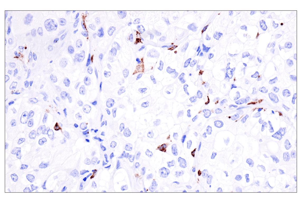 Immunohistochemistry Image 3: Langerin (F8L8I) Rabbit Monoclonal Antibody