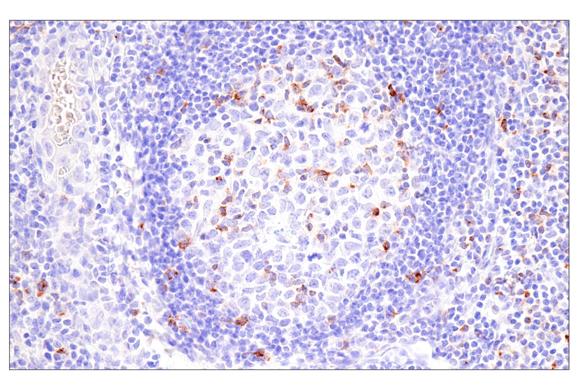 Immunohistochemistry Image 5: CTLA-4 (E2V1Z) Rabbit Monoclonal Antibody