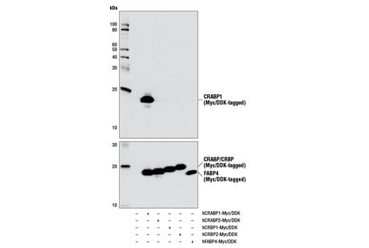 Western Blotting Image 3: CRABP1 (D5W9A) Rabbit Monoclonal Antibody
