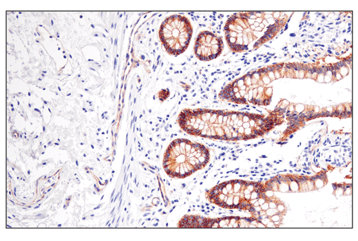 Immunohistochemistry Image 3: Occludin (E6B4R) Rabbit Monoclonal Antibody
