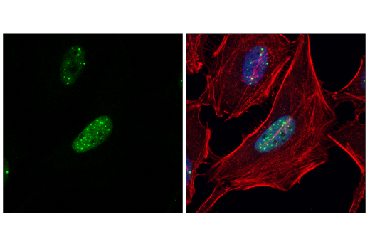 Immunofluorescence Image 3: PML (E6S9L) Rabbit Monoclonal Antibody