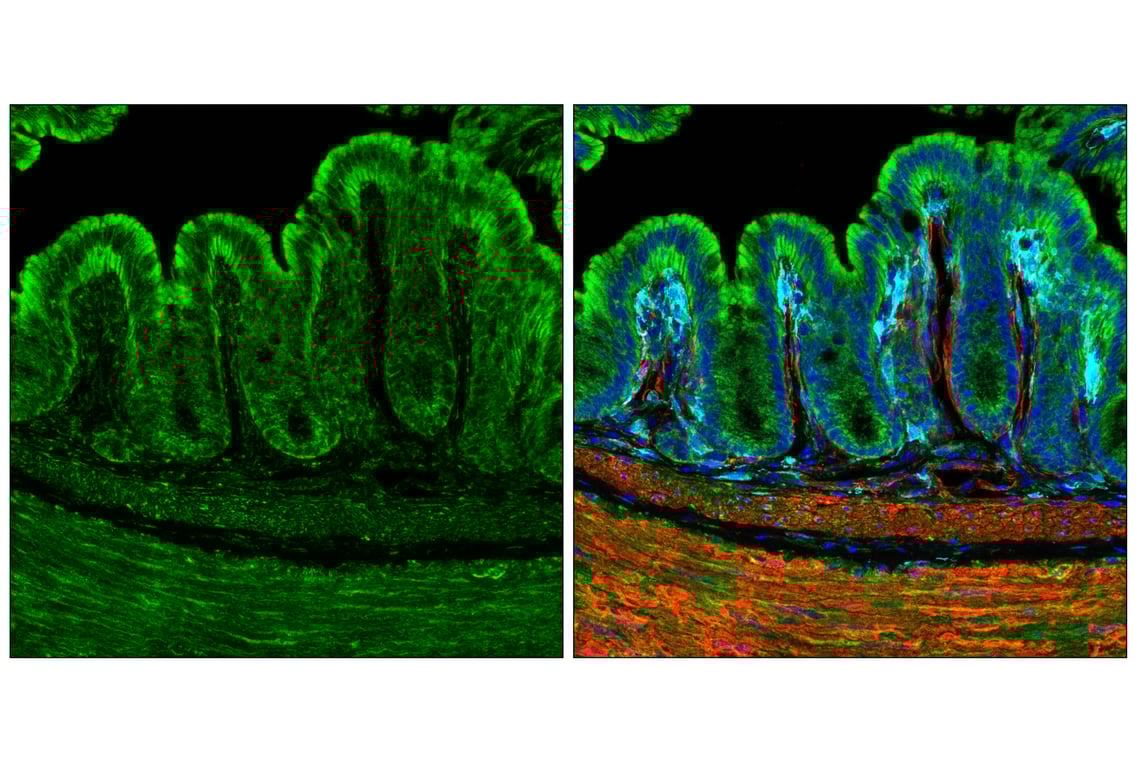 Immunofluorescence Image 3: TOM70 (E7E1M) Rabbit Monoclonal Antibody