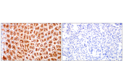 Immunohistochemistry Image 3: MUC5AC (E9V1O) Rabbit Monoclonal Antibody